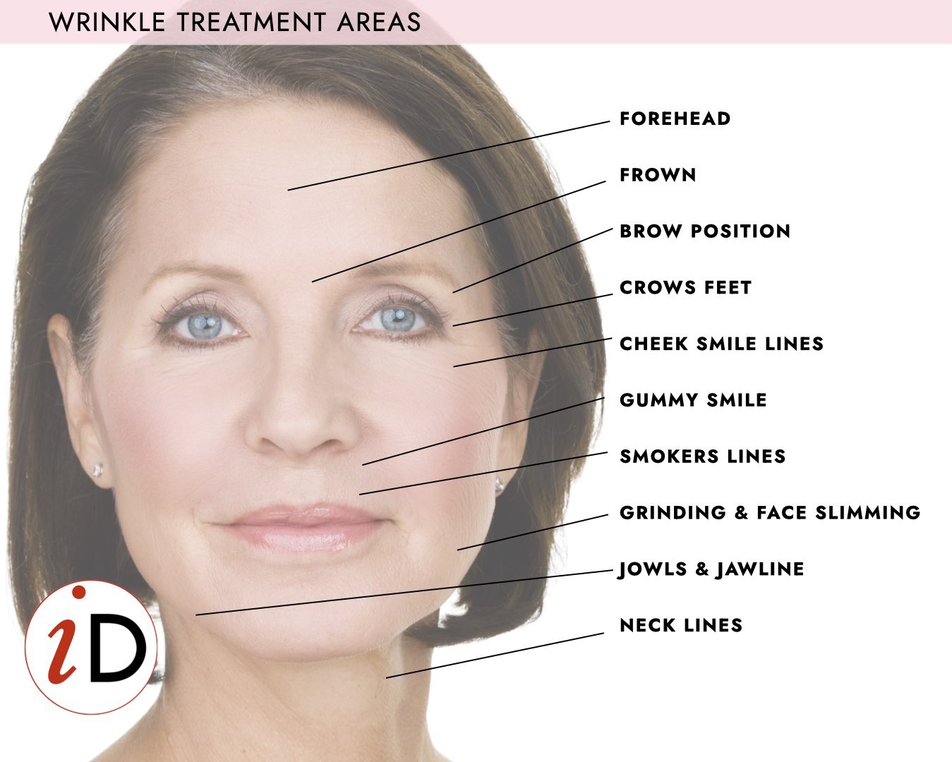 wrinkle treatment